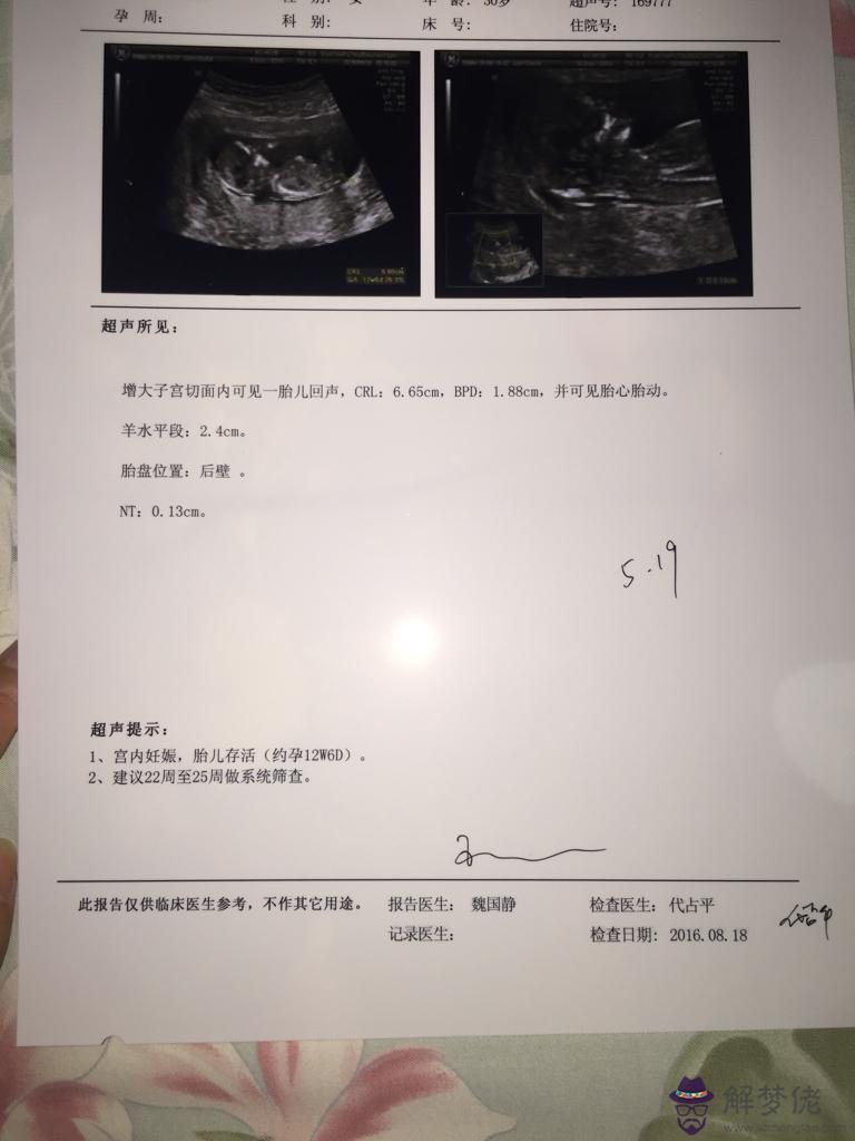 驗孕越早越容易生男孩：一般的驗孕試紙顯示結果的時間一樣麼?哪種會比較準確?
