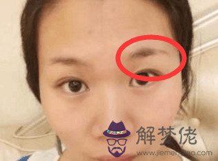 女人兩眉之間有八字紋:眉中間的八字紋