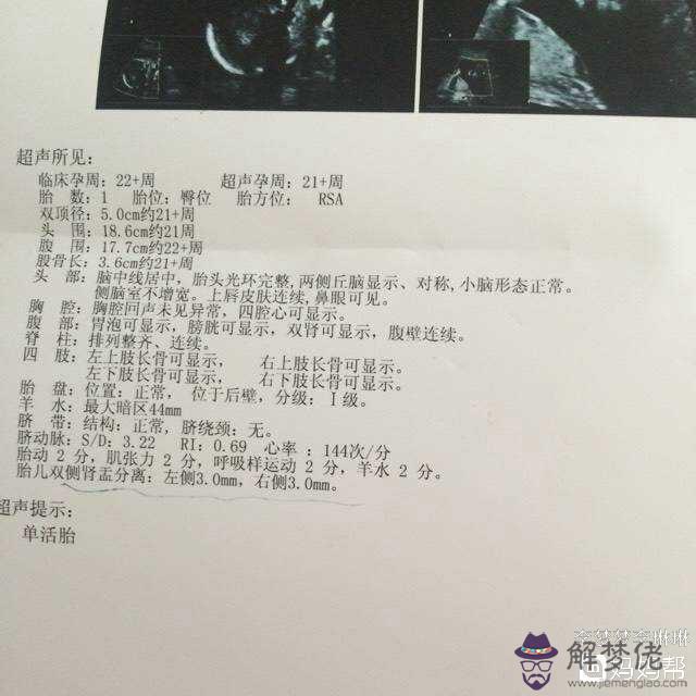 我有一個很準生男生女:懷女兒最準的癥狀到底是啥啊,我太想要個女兒了
