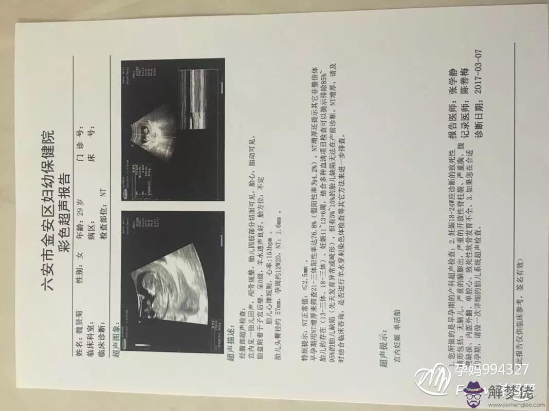 算男女超準方法口訣:六個月比超鑒定男女性別的準確率有多高