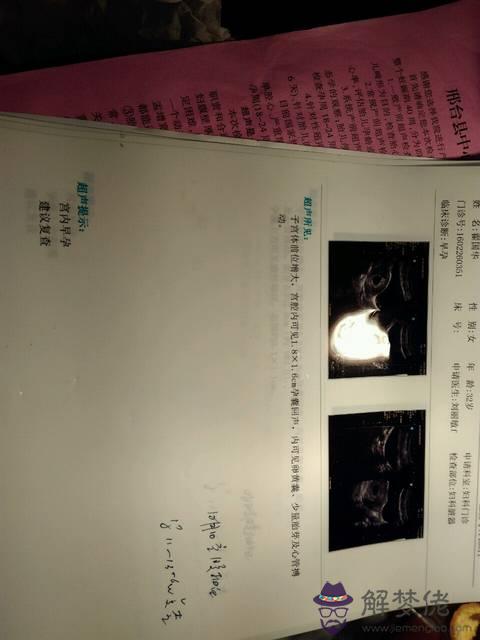 我33周歲,末次月經歷2月12日,做幾次b超,都看不出來是男孩女孩,還有什麼方法識別,親們,幫