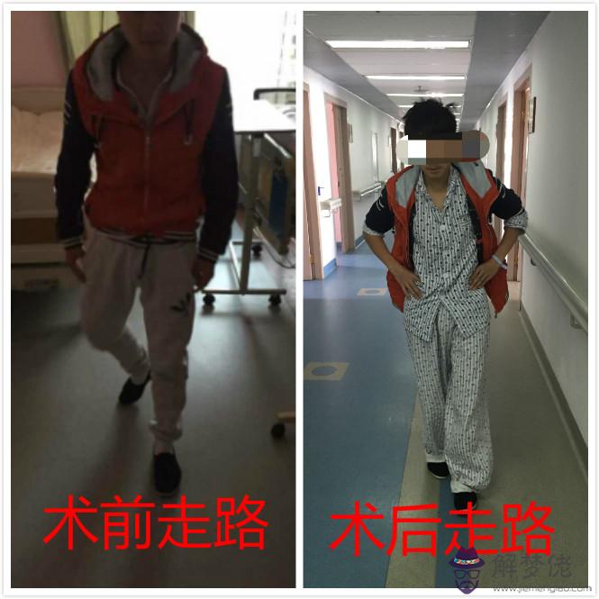 走路外八字男人的命運:男人走路外八字好看嘛?