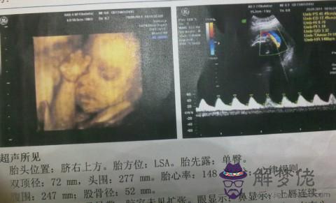 5個月胎兒彩超:懷孕5個月胎寶寶發育什麼?