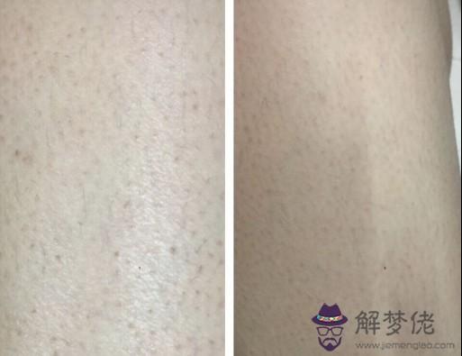 膚色不均怎麼調理:膚色不均怎麼辦?