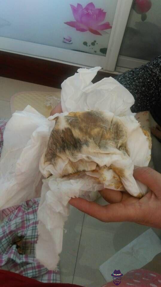 小孩不拉屎怎麼辦:寶寶七個月,經常七八天不拉屎正常嗎怎麼辦