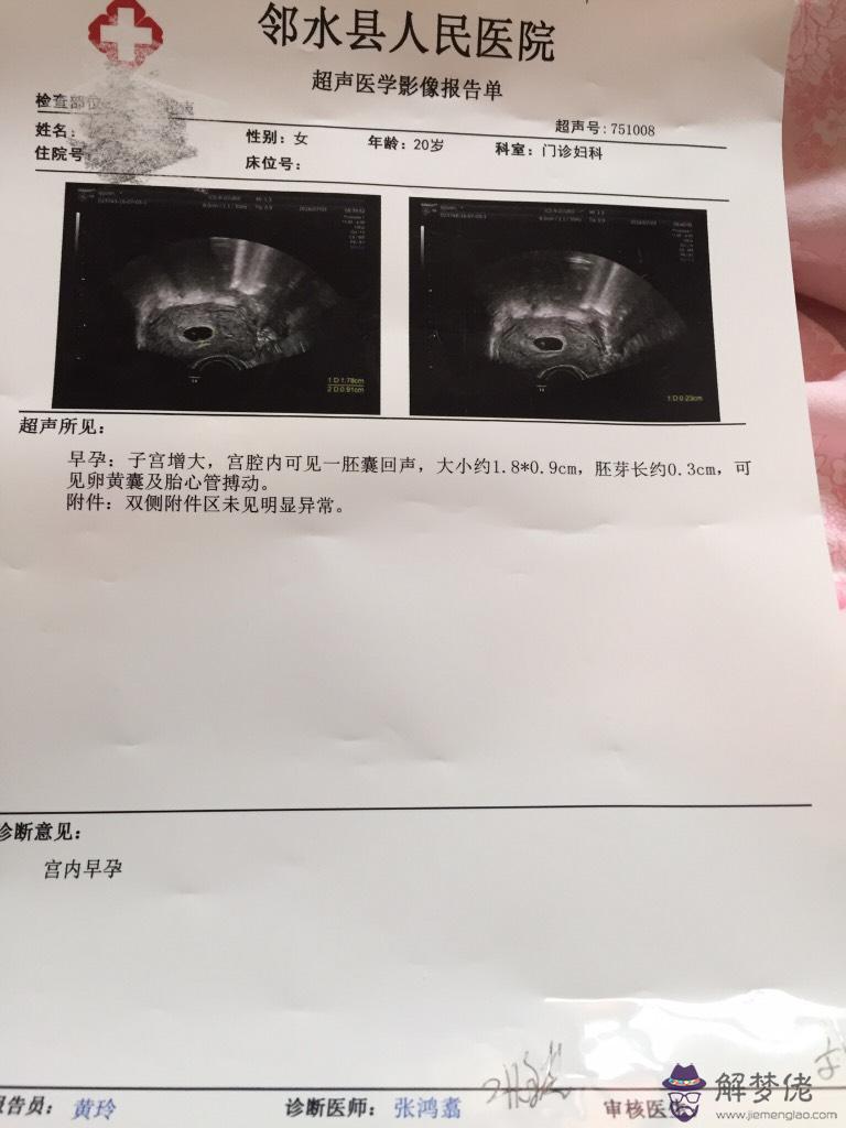 產檢都檢查什麼:產檢都包括什麼項目?