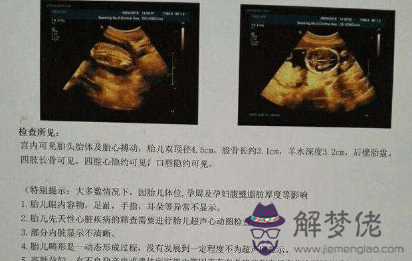 b超單子怎麼看男女:看b超單子怎麼看男孩女孩有依據嗎?