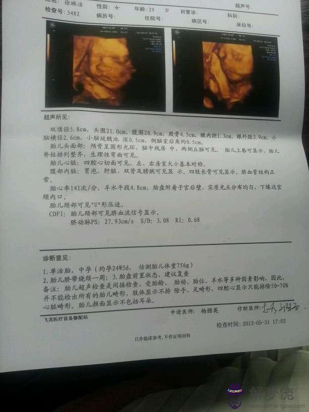 孕婦低要注意什麼:孕17周:懷孕18周,檢查出低,要注意什麼嗎