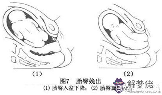 胎兒頂臀徑標準男女:胎兒頂臀長83mm是多少周的胎兒?