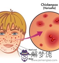 自然回奶脹痛一般多久:自然回奶都需要幾天啊回奶以后胸還會痛嗎