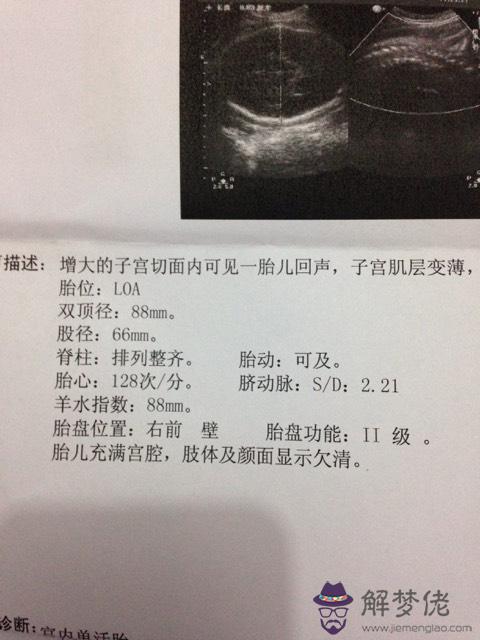 附著于后壁是什麼意思:：附著于后壁，0級.是什麼意思