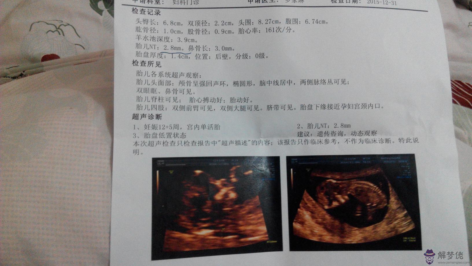 nt值多少為正常:十二周做nt,十三周nt值會比十二周高多少
