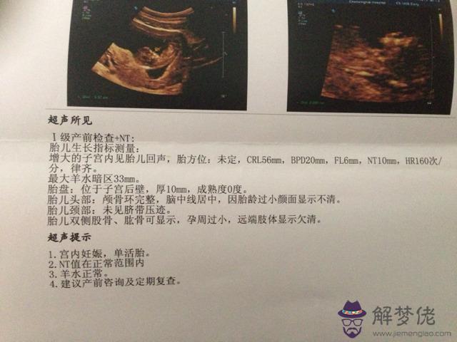 nt值多少為正常:NT檢查數值偏高啊,十分擔心.你們都是多少