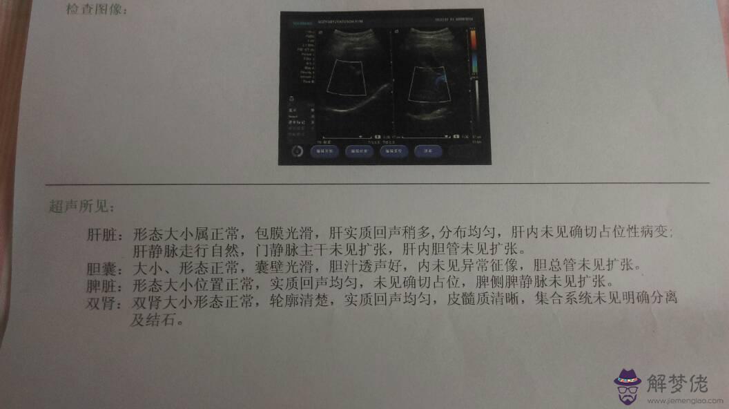婚前體檢會體檢出來以前做過人工的嗎?還有我自己去體檢,結果男朋友會不會知道的啊?