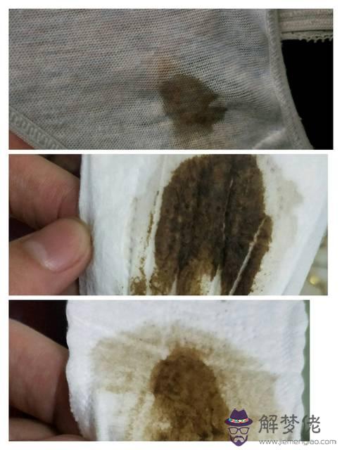 會懷孕嗎:是咋回事會不會影響懷孕啊,備孕期間這樣的