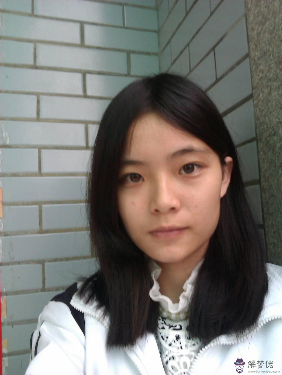 肉痣可以點掉嗎:請問一下肉痣可以點掉嗎?會不會留疤?