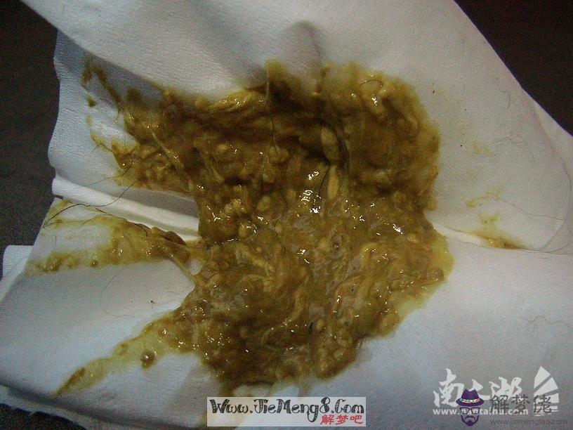 做夢拉屎是什麼意思:做夢解是什麼意思