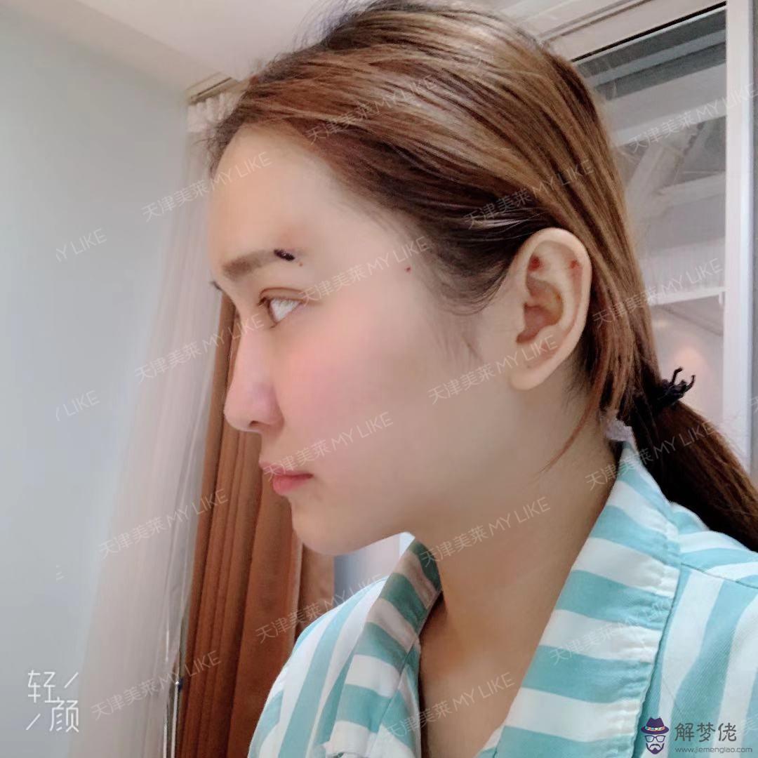 讓額頭變飽滿小妙招:怎麼去抬頭紋小妙招
