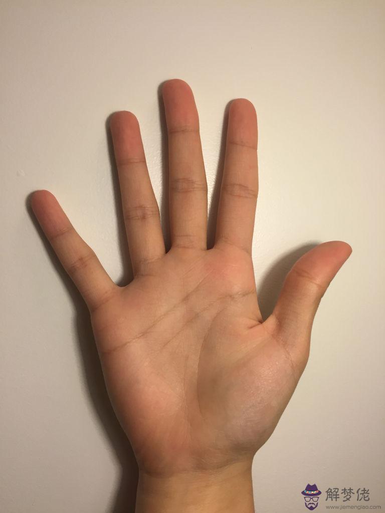 我是女的,右手感情線有1.5厘米的島紋是暗示著什麼,還有左手生命線出現分岔