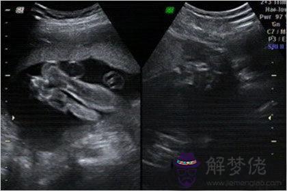 怎麼判斷生男生女最準確:一般生男生女什麼方法最準?