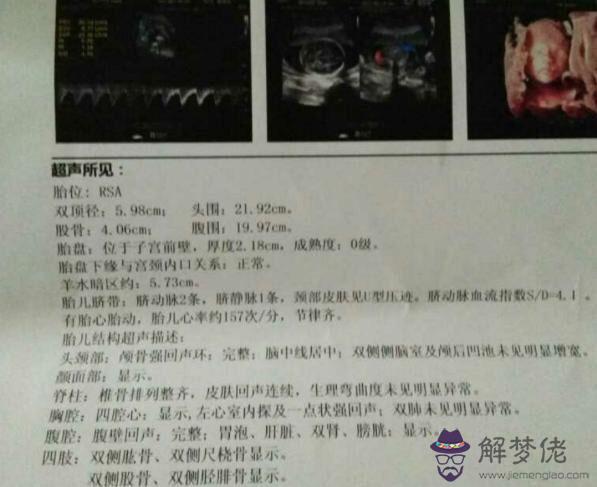 五行缺金怎麼取名:命里缺金，怎麼取名